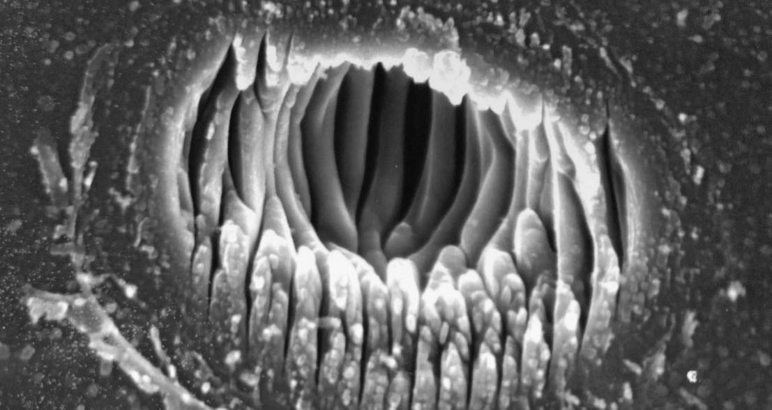 ablation